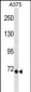EOMES Antibody(N-term)